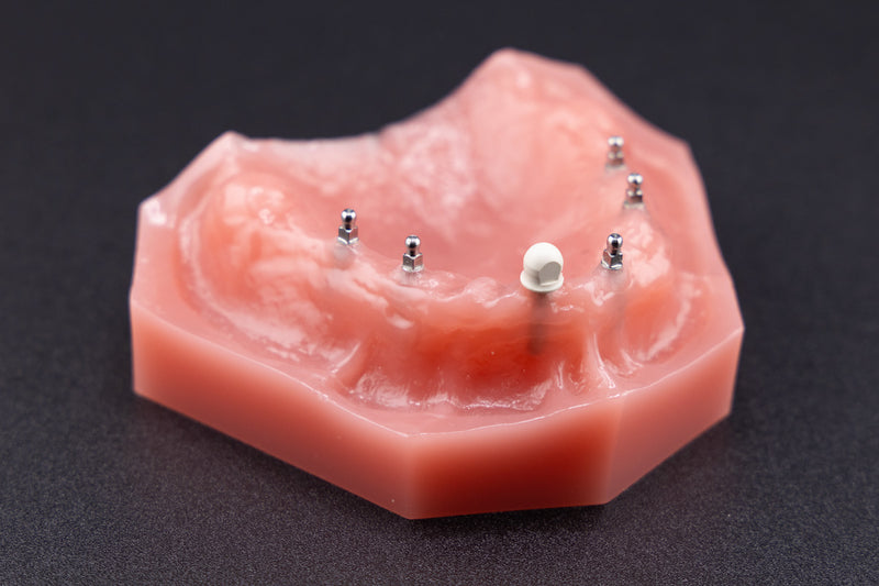 Shatkin F.I.R.S.T. Tru-Lok PEEK Attachment