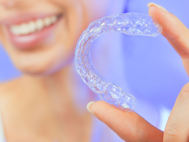 Krystal Klear Aligners