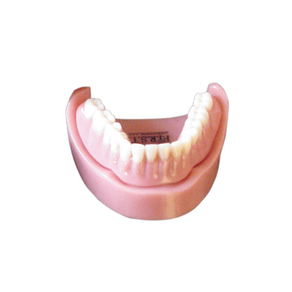 Mandibular Full Denture Model